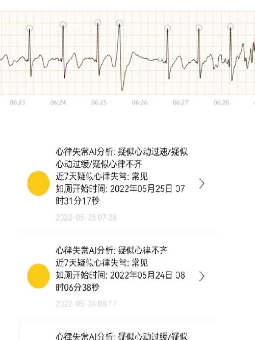程序员过劳加班问题_2025职场励志故事_互联网行业加班现状